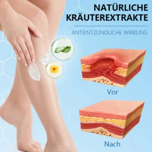 Ceoerty™ Krampfadern-Creme mit Hydrogel