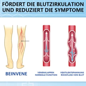 Ceoerty™ Krampfadern-Creme mit Hydrogel