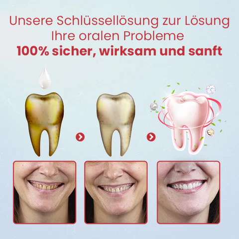 Ceoerty™ PRODent Probiotische Whitening-Zahnpasta