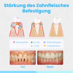 Ceoerty™ RevitaDent Zahnfleisch-Reparatur-Streifen