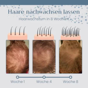 Ceoerty™ Root Renew Pflegendes Haarpeeling