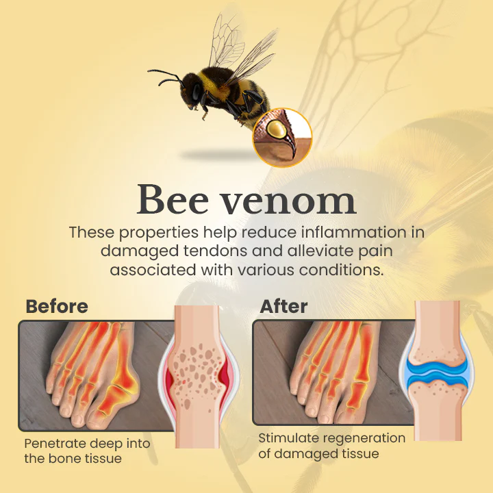 Ceoerty™ ToeCure Bee Venom Treatment Cream