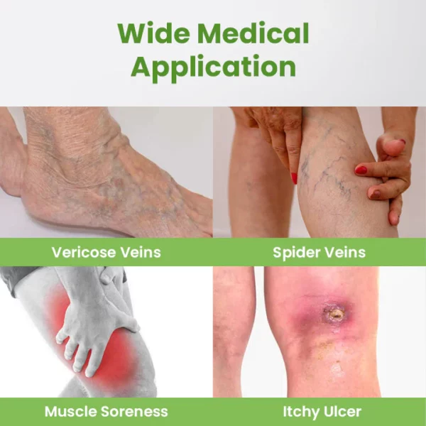 Ceoerty™ Varicose Vein PRO Xpert Spray - Image 6