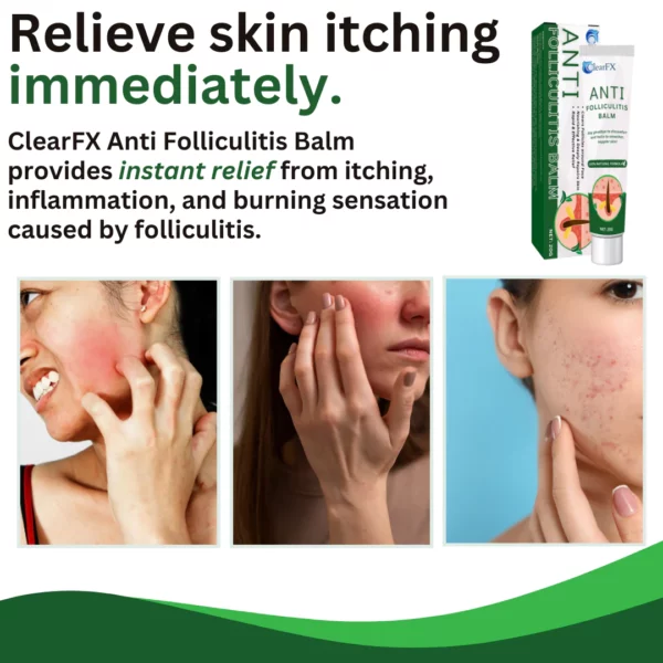 ClearFX™ Anti-Folliculitis Balm - Image 4