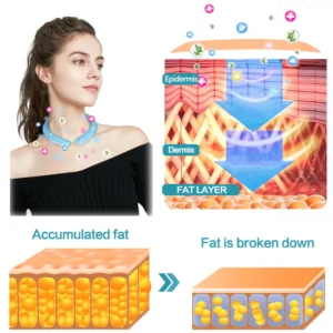 CoolTime™ Ion Lymphatic Relief Coolsculpting Neck Tube