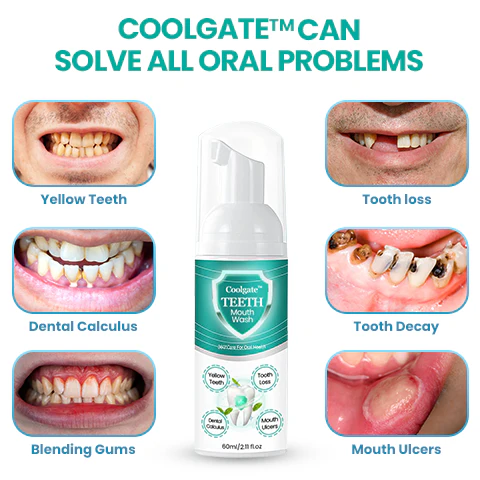 Coolgate™ TEETH Mouthwash