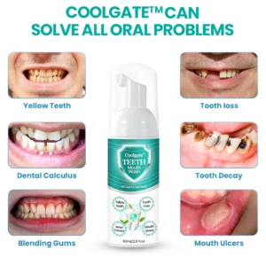 Coolgate™ TEETH Mouthwash