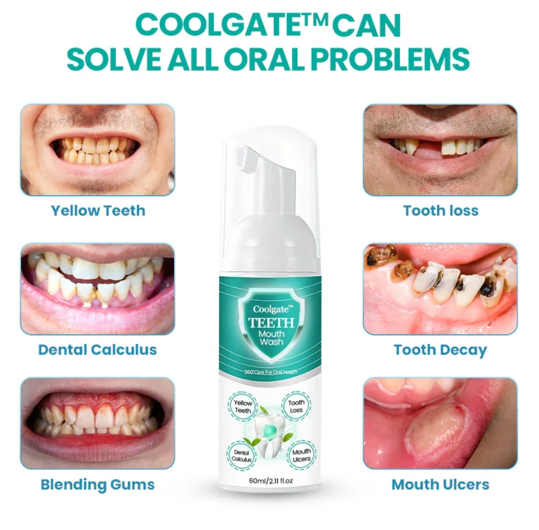 Coolgate™ TEETH Mouthwash