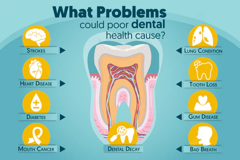 DAZZLE™ TEETH Mouthwash - Solve all Oral Problems