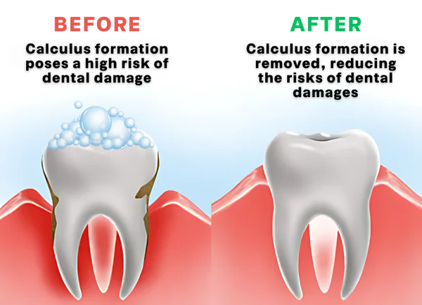 DENBRITE™ Oral Care Essence Foam