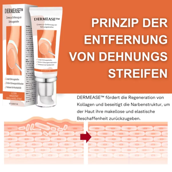 DERMEASE™ Creme zur Entfernung von Dehnungsstreifen - Image 2