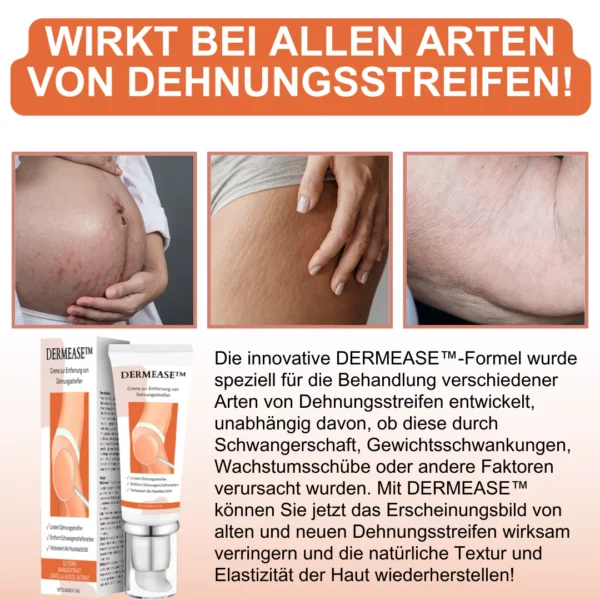 DERMEASE™ Creme zur Entfernung von Dehnungsstreifen - Image 3