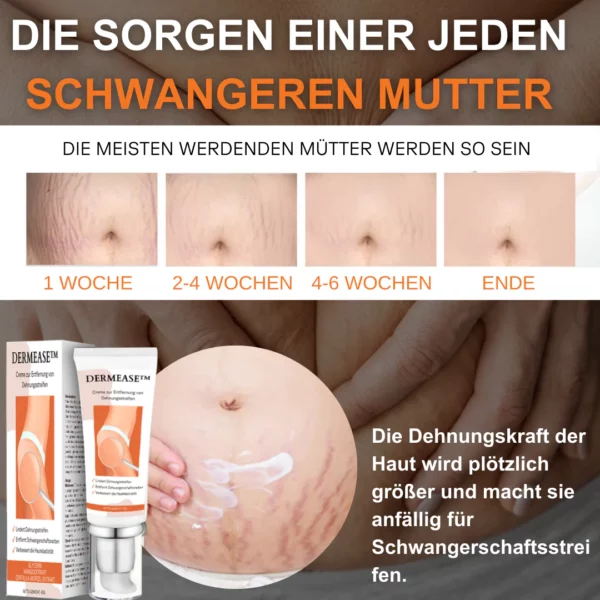 DERMEASE™ Creme zur Entfernung von Dehnungsstreifen - Image 4