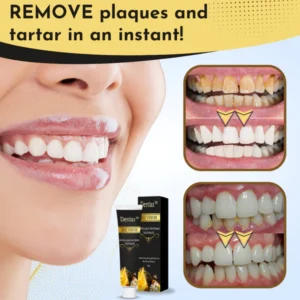 Dentax™ Bee Venom Antiplaque Whitening Toothpaste