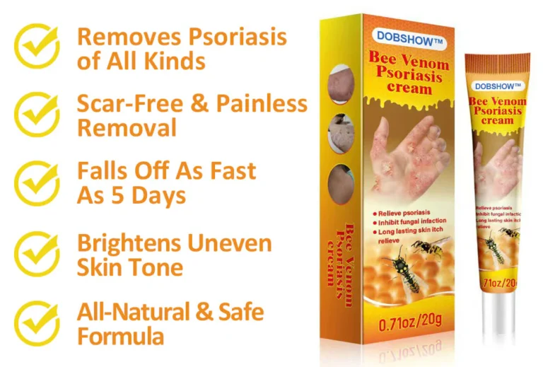 Dobshow™ Bee Venom Psoriasis Relief Cream