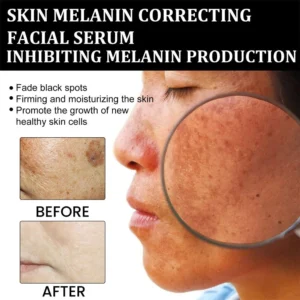 Dobshow™ Melanin Correcting Facial Serum