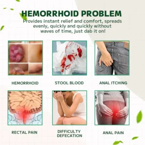 EAST MOON™ Hemorrhoidal Ointment