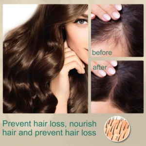 EELHOE™ Hair Boost Ginger Cream