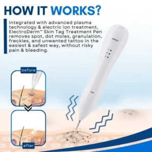 ElectroDerm™ Skin Tag Treatment Pen