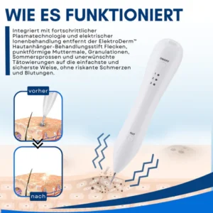 ElektroDerm™ Hautanhänger-Behandlungsstift