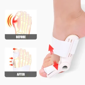 FlexBun™ Adjustable Painless Bunion Splint Corrector