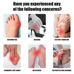 FlexBun™ Adjustable Painless Bunion Splint Corrector