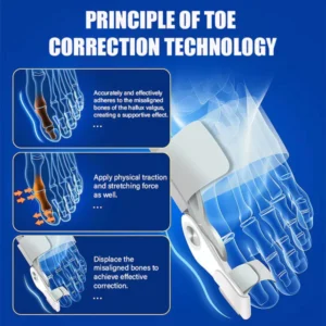 FlexBun™ Adjustable Painless Bunion Splint Corrector