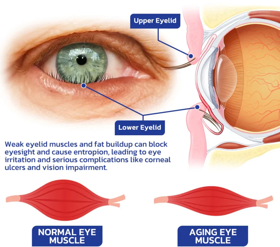 Flysmus™ OpenVision Bee Venom Lifting Eye Gel