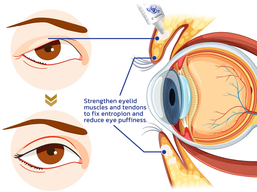 Flysmus™ OpenVision Bee Venom Lifting Eye Gel