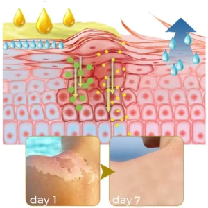 FurzeroTM Acanthosis Nigricans Peeling Oil