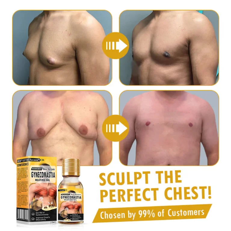 Furzero™ MenRobust Bee Venom Gynecomastia Heating Oil