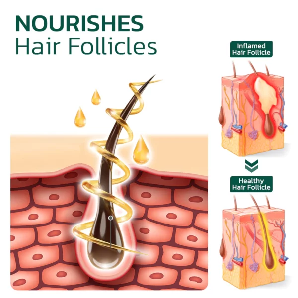 GFOUKTM Scalp Folliculitis Therapy Oil - Image 3