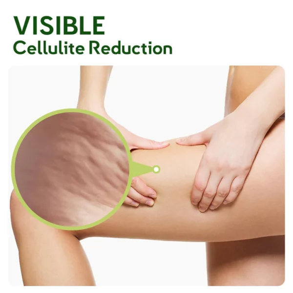 GFOUK™ MugwortsLegs Cellulite Reduction Patches - Image 2