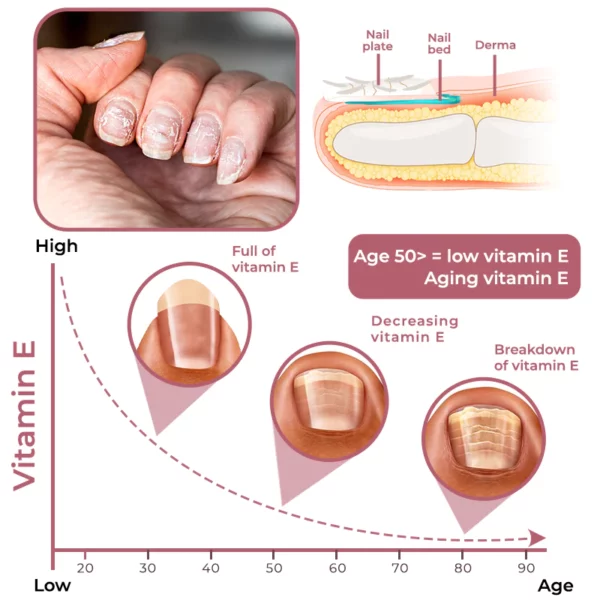 GFOUK™ Peeling Nail Therapy Vitamin E Serum - Image 3