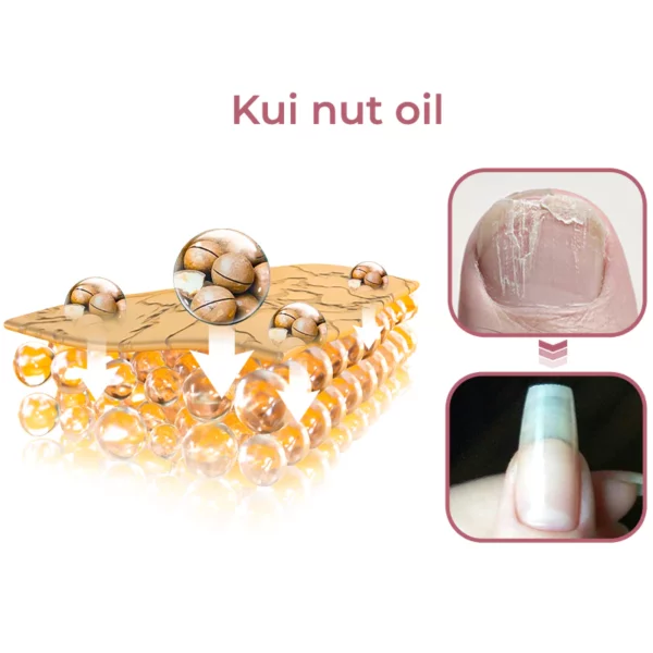 GFOUK™ Peeling Nail Therapy Vitamin E Serum - Image 6