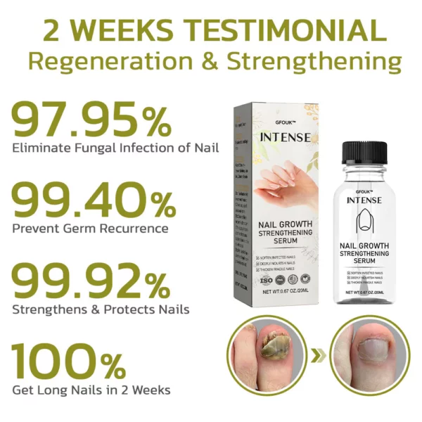 GFOUK™️ Intense Nail Growth and Strengthening Serum - Image 2