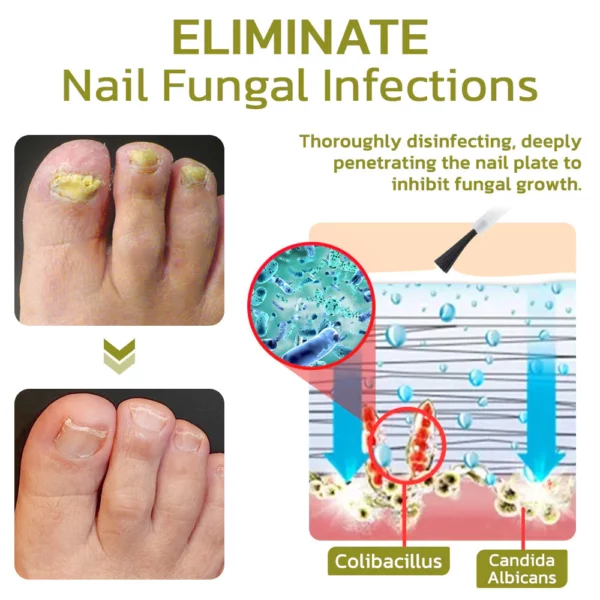 GFOUK™️ Intense Nail Growth and Strengthening Serum - Image 5