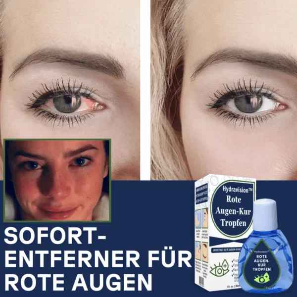 Hydravision™ Rote Augen-Kur Tropfen