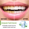 IvoryAm™ Tartar Removal & Tooth Whitening Serum