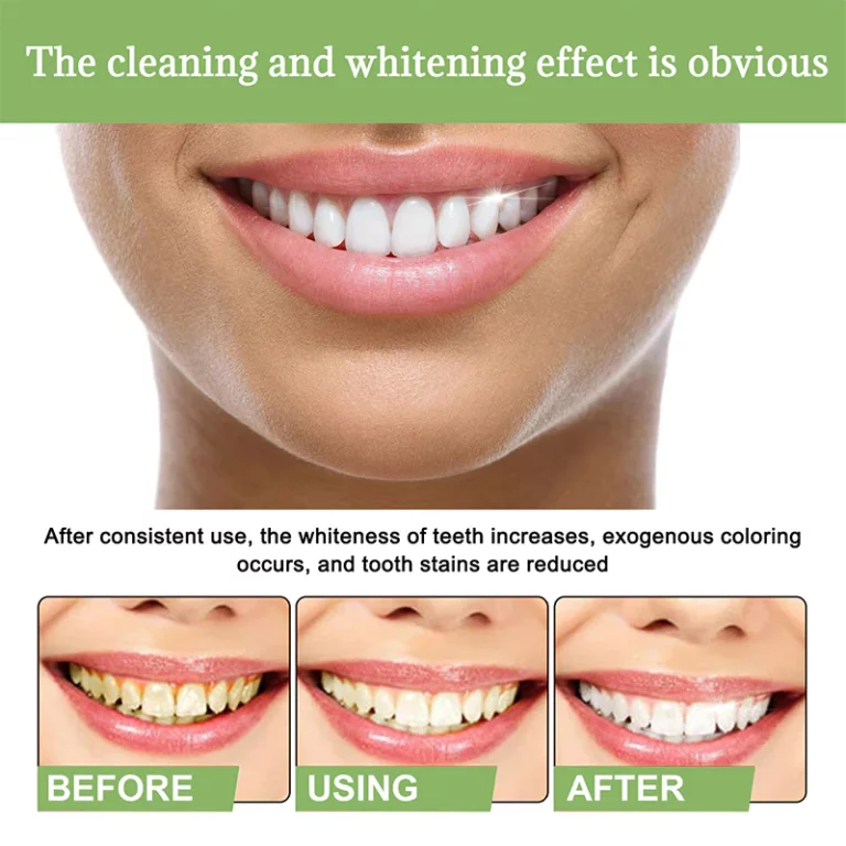 IvoryAm™ Tartar Removal & Tooth Whitening Serum