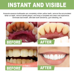 IvoryAm™ Tartar Removal & Tooth Whitening Serum