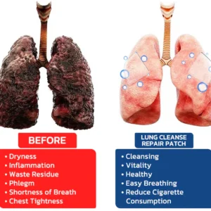 LUNGDERM™ Herbal Lung Cleansing Patch