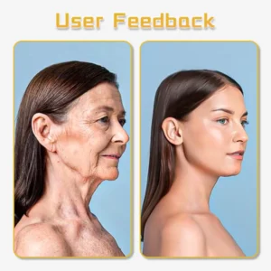 LunaLoom™ UltraRenew Ultrasonic Facelift Device