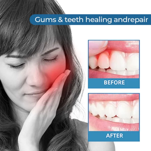 MEDix™ Toothache Therapy Spray - Image 3