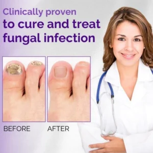 NailClear™ Nail Fungal Essence