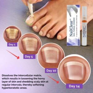 NailClear™ Nail Fungal Essence