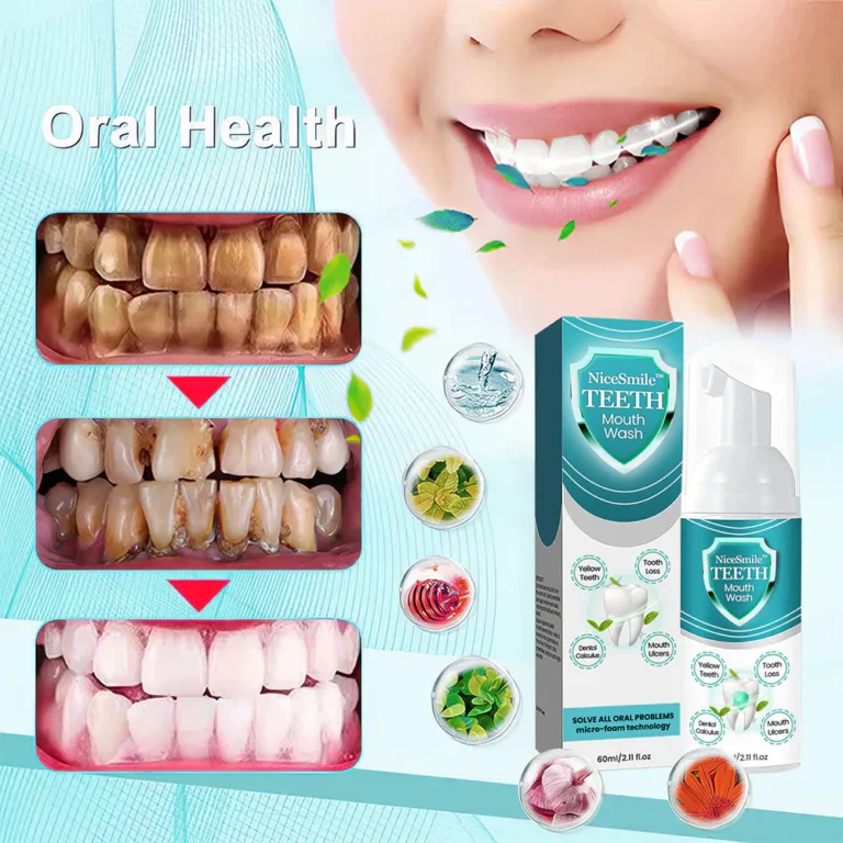 NiceSmile™ TEETH Mouthwash - Solve All Oral Problems