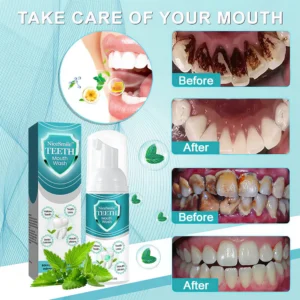 NiceSmile™ TEETH Mouthwash - Solve All Oral Problems