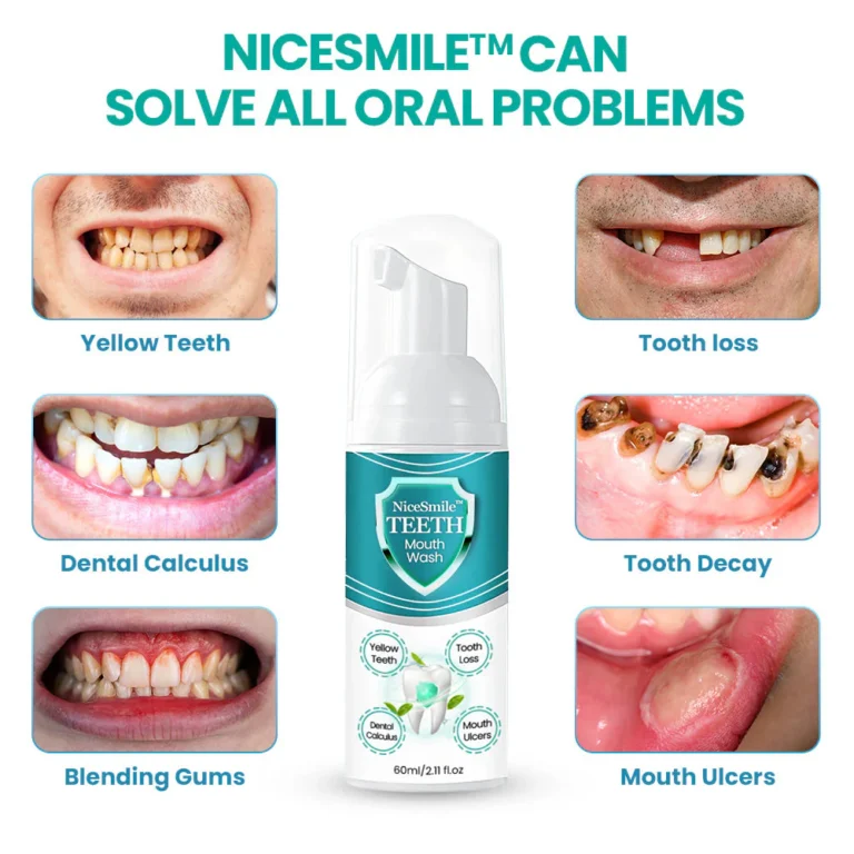 NiceSmile™ TEETH Mouthwash - Solve All Oral Problems