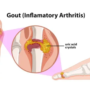 Nurbini™ ArthriBee Joint and Bone Therapy Cream